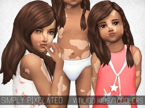 Alpha SimplyPixelated Vitiligo - The Sims 4 Custom Content