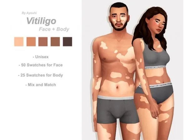Vitiligo by ayoshi-sims
