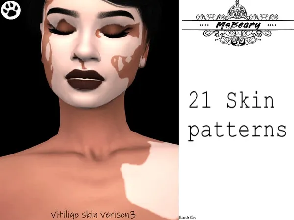 Alpha Vitiligo V3 - The Sims 4 Custom Content