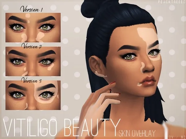 Maxis Match Vitiligo Beauty Skin Overlay N2 - The Sims 4 Custom Content