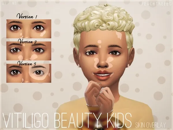 Alpha Vitiligo Beauty Skin Overlay KIDS N3 - The Sims 4 Custom Content