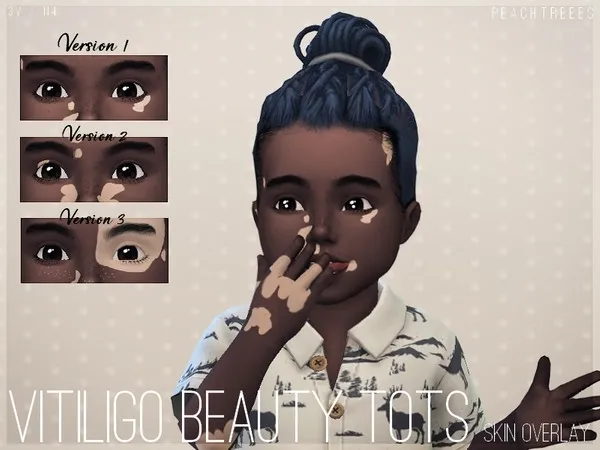 Alpha Vitiligo Beauty Skin Overlay TODDLERS N4 - The Sims 4 Custom Content