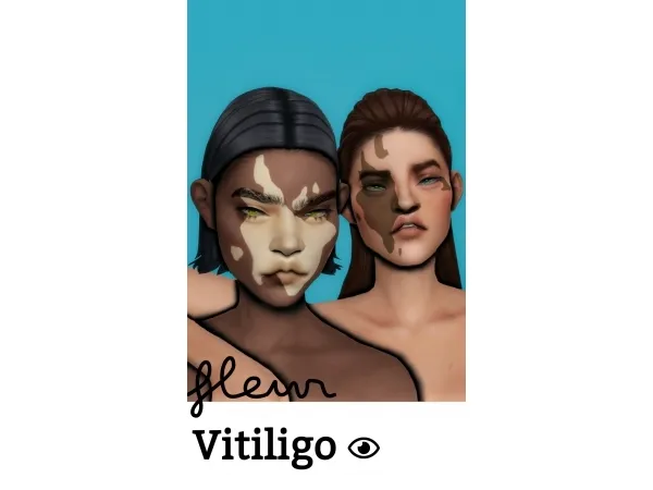 Mix Fleur Vitiligo - The Sims 4 Custom Content