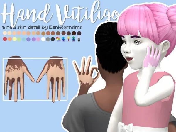 Alpha Hand Vitiligo - The Sims 4 Custom Content