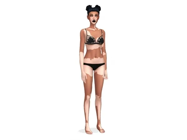 Mix Cashu2019s Vitiligo (Updated) - The Sims 4 Custom Content