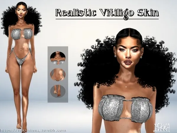 Alpha ISKRAsims4's ISKRA realistic vitiligo skin - The Sims 4 Custom Content