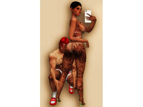 Alpha Souffrant Vitiligo - The Sims 4 Custom Content