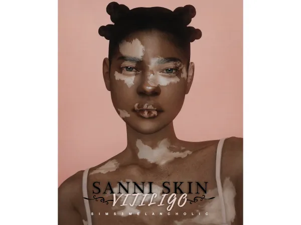 Alpha sanni sking vitiligo by sims3melancholic - The Sims 4 Custom Content