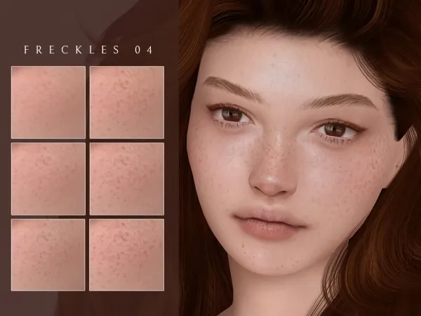 Freckles 04