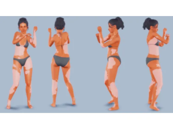 to Ayoshis Vitiligo - The Sims 3 Custom Content