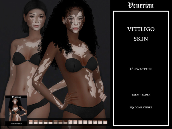 Sims 4 Alpha Skintones CC: Vitiligo Skin - Female - by Venerian