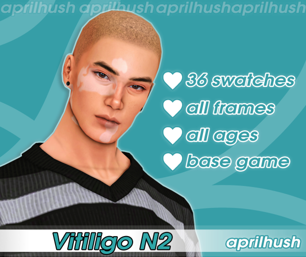 Maxis Match Vitiligo N2 by simsfinds - The Sims 4 Custom Content
