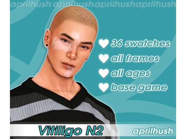 Vitiligo N2 by aprilhush